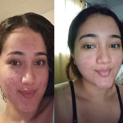 Antes y después real · comunidad Hanna's