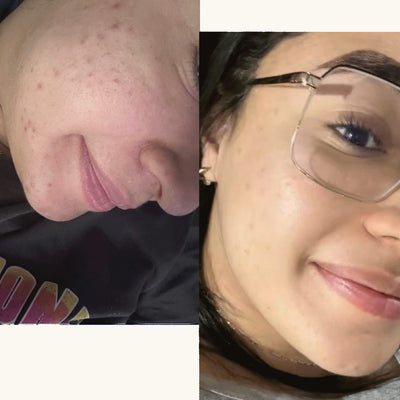 Antes y después real · comunidad Hanna's