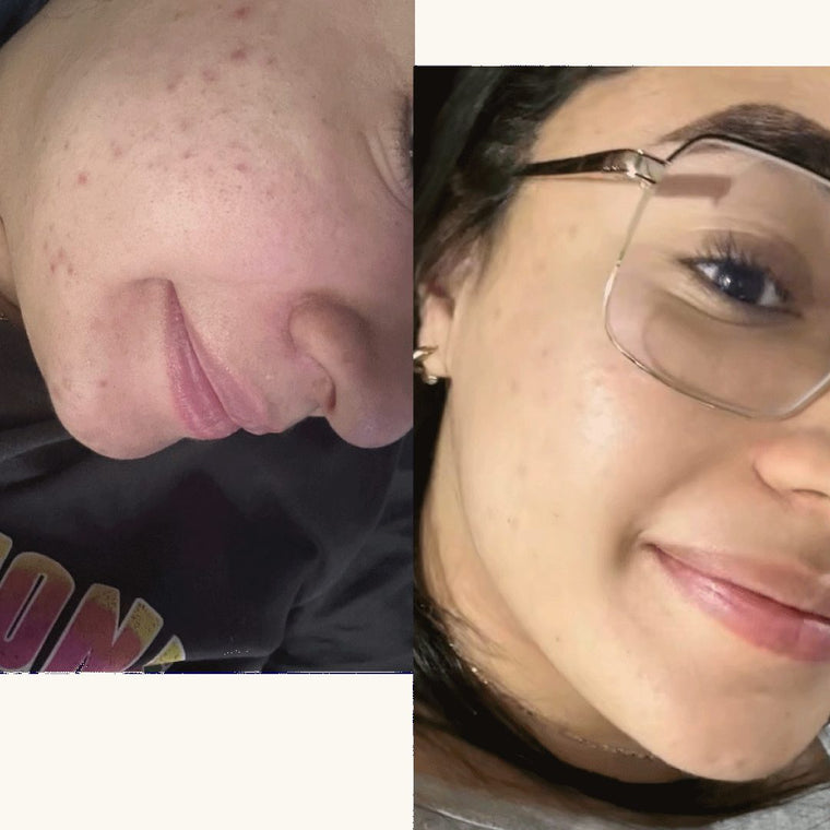 Antes y después real · comunidad Hanna's
