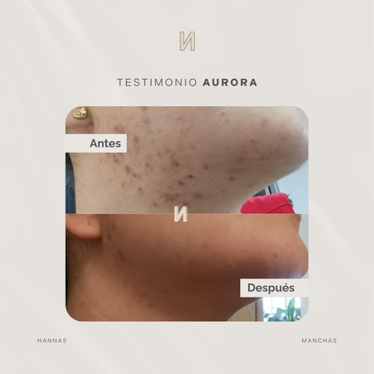 KIT AURORA
