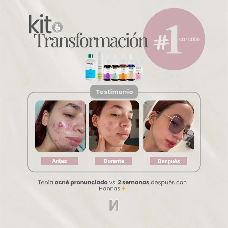 Banner de Hannas que muestra el "Kit Transformación" y un testimonio de tres fotos