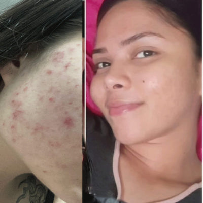 Antes y después real · comunidad Hanna's
