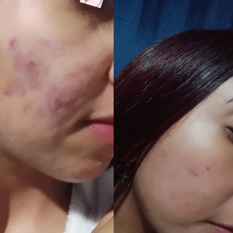 Antes y después real · comunidad Hanna's