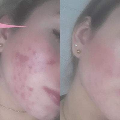 Antes y después real · comunidad Hanna's