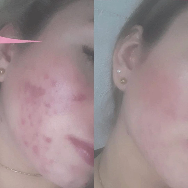 Antes y después real · comunidad Hanna's