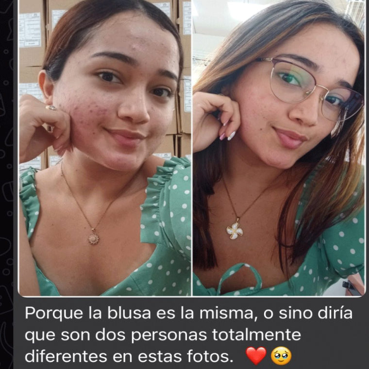 Antes y después real · comunidad Hanna's
