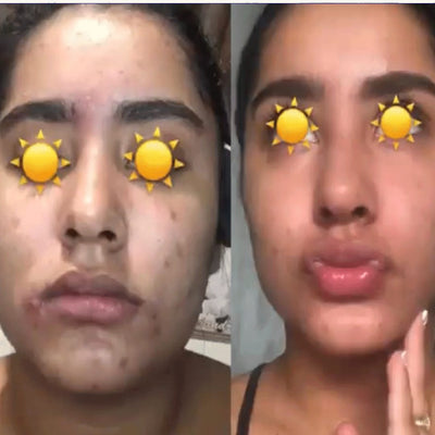 Antes y después real · comunidad Hanna's